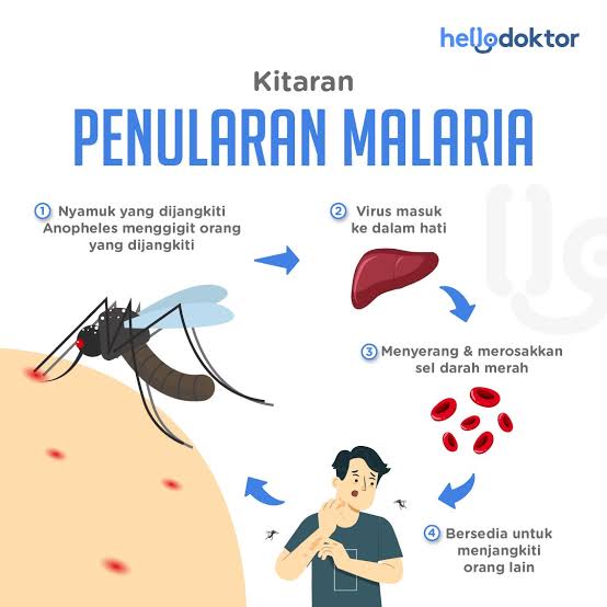 Berikut Ini Gejala dan Cara Pencegahan Malaria