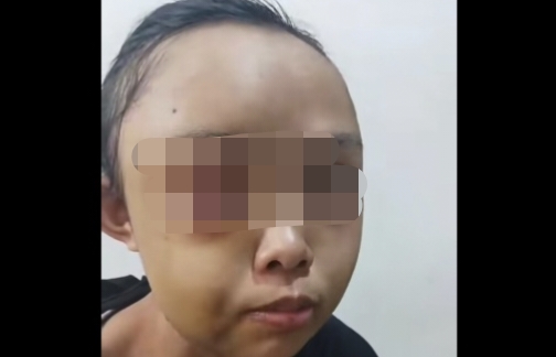 Gadis Yatim Piatu di Kampar Dianiaya di Depan Warga Viral di Medsos