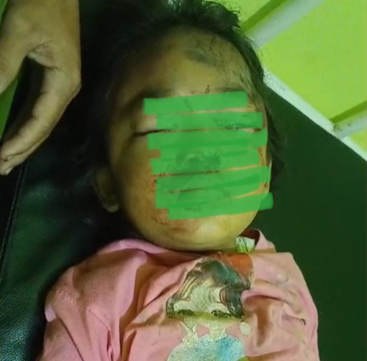 Gajah Liar Ngamuk di Rumbai, Seorang Anak Kecil Jadi Korban