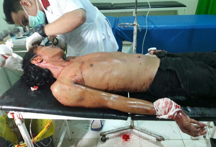 Pemuda ini Jadi Buruan Polisi Inhil Gegara Bacok Temen sendiri 